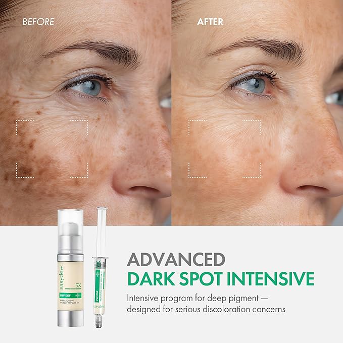 Easydew DW-EGF Melatoning Ampoule 5X - Hydrating Dark Spot Serum with Niacinamide & Glutathione for Uneven Skin - Fast Absorbing Day & Night Ampoule Korean Skin Care (Bottle 1.01 fl oz, EGF 5X)