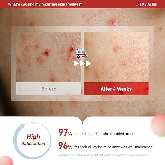 Zeroca 81 Korean Calming Serum for Acne-Prone & Oily Skin – Balances Oil-Water, Soothes Redness, Fades Post-Blemish Marks, Firms & Hydrates (1.01 fl.oz. 30 ml)