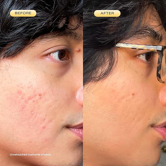 KraveBeauty 24 Carrot Retinal - 30ml, Korean Skincare-Inspired Gentle Retinal Serum, Smooths Skin Texture, Supports Skin Barrier, Lightweight Non-Sticky Gel, Nourishes with Upcycled Carrot Extract