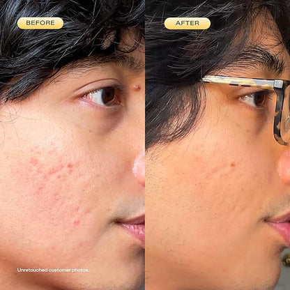 KraveBeauty 24 Carrot Retinal - 30ml, Korean Skincare-Inspired Gentle Retinal Serum, Smooths Skin Texture, Supports Skin Barrier, Lightweight Non-Sticky Gel, Nourishes with Upcycled Carrot Extract