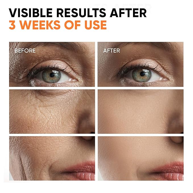 Vitamin C Serum for Face with Stem Cells, Niacinamide, Hyaluronic Acid & Vitamin E – Anti-Aging Retinol Facial Serum Glycolic Acid & Retinal for Brightening, Hydrating & Firming Skin – Made in USA