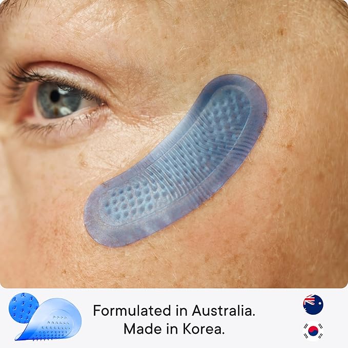 Qure Micro-Infusion Anti Wrinkle Patches for Smile Line, Frown lines, Under Eye Bags, Puffiness, Crow's Feet - Retinol, Caffeine, Niacinamide & Peptides - Dissolvable for Overnight Use - 16 Pairs