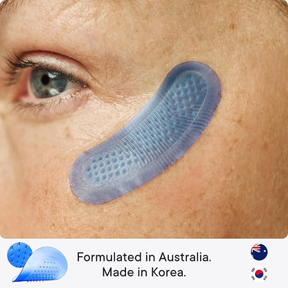 Qure Micro-Infusion Anti Wrinkle Patches for Smile Line, Frown lines, Under Eye Bags, Puffiness, Crow's Feet - Retinol, Caffeine, Niacinamide & Peptides - Dissolvable for Overnight Use - 16 Pairs