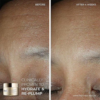 RoC Retinol Correxion Line Smoothing Eye Cream + Retinol Serum Capsules For Night + Max Hydration Crème With Hyaluronic Acid For Day, Skin Care Routine for Women and Men