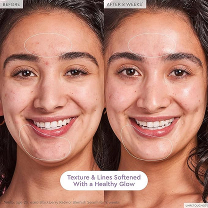 Glow Recipe Gentle Blackberry Retinol Night Serum - Anti Aging Korean Face Serum for Sensitive Skin + Hydrating Triple Retinoids & Glycerin to Clarify Blemishes, Smooth Texture, Lines & Wrinkles, 30ml