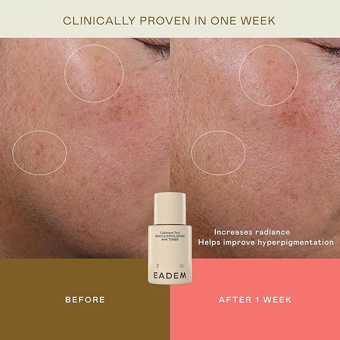 EADEM Gentle Exfoliating AHA & PHA Toner, Exfoliating Face Serum with Tranexamic Acid, AHA Exfoliant & Pore Minimizer for Face and Body, Acne Spot Serum, 5.0 oz, Cashmere Peel
